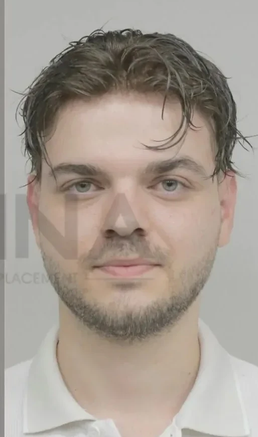 Onna Hair’de erkek protez saç uygulaması yapılmış danışan