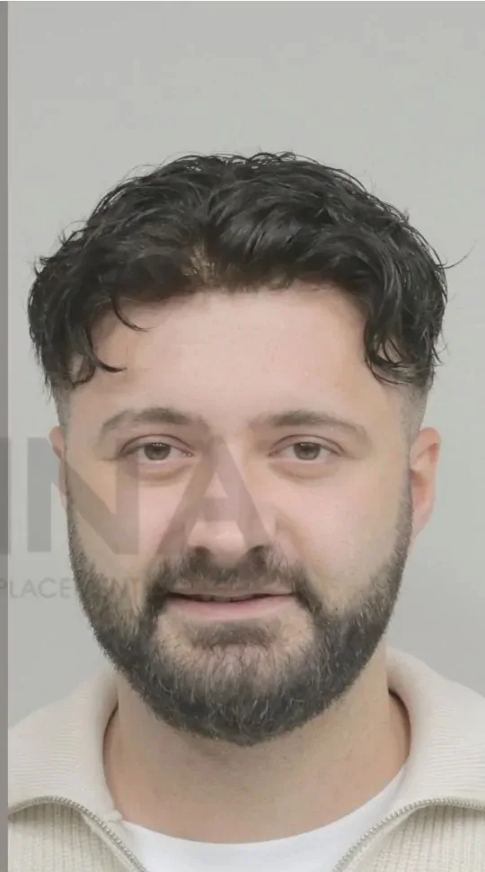 Erkek protez saç uygulaması yapılmış Onna Hair danışanı
