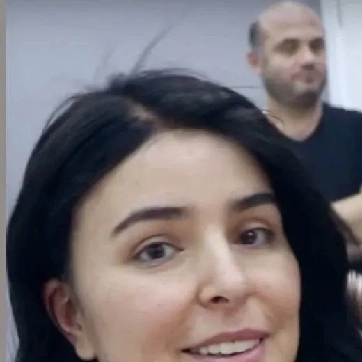 Kadın protez saç uygulaması yapılmış Onna Hair danışanı