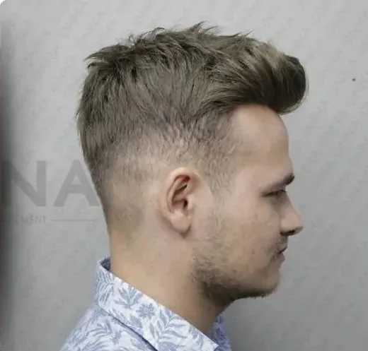Erkek protez saç uygulaması yapılmış Onna Hair danışanı