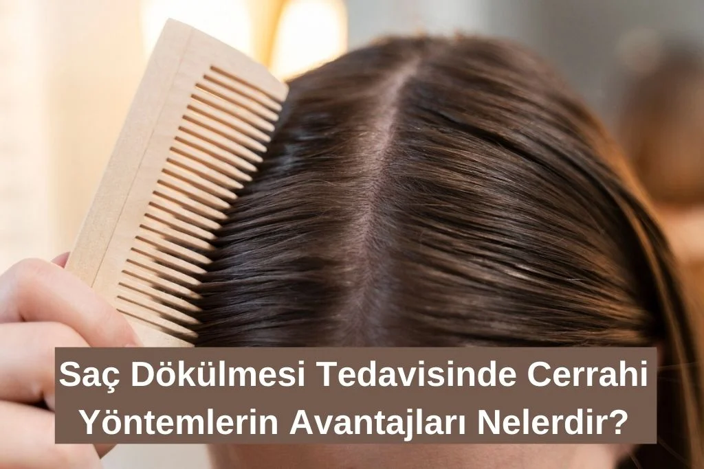 Saç Dökülmesinde Uygulanan Cerrahi Yöntemler