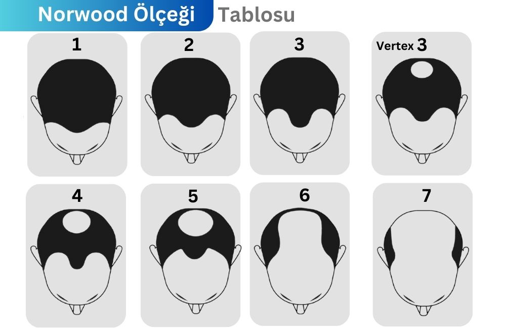 Norwood Ölçeği