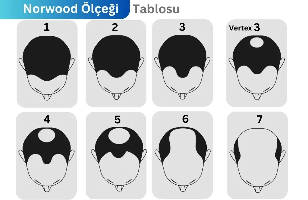 Norwood Ölçeği