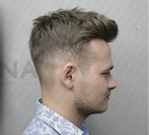 Onna Hair danışanı, protez saç uygulaması öncesi ve sonrası — sonrası