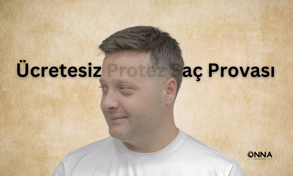 Ücretsiz Protez Saç Provası ve Avantajları